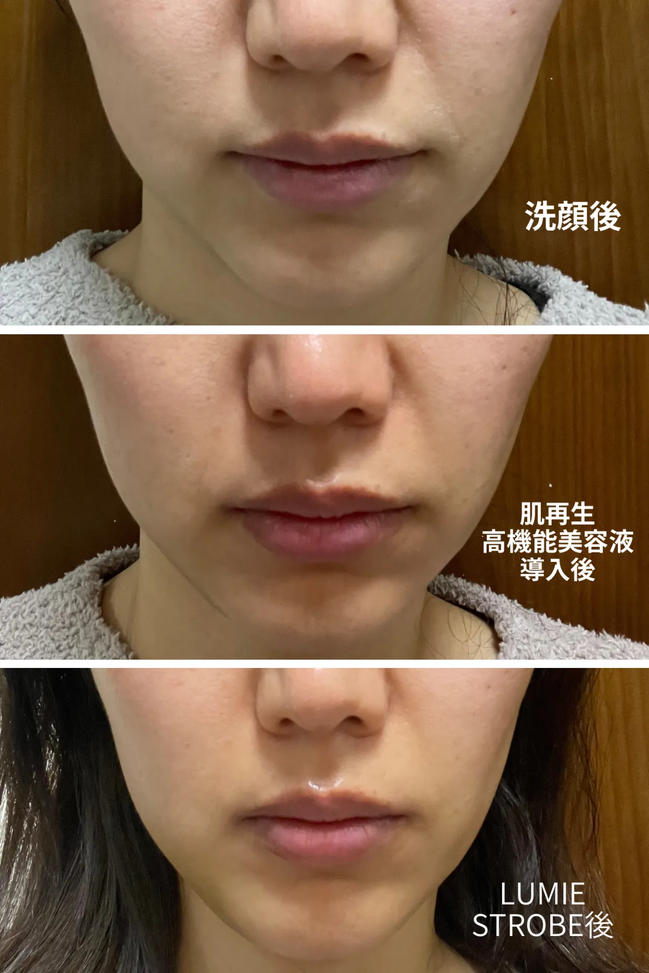 スキンケアで－10歳肌